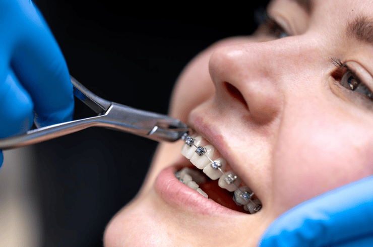 Braces & Orthodontics